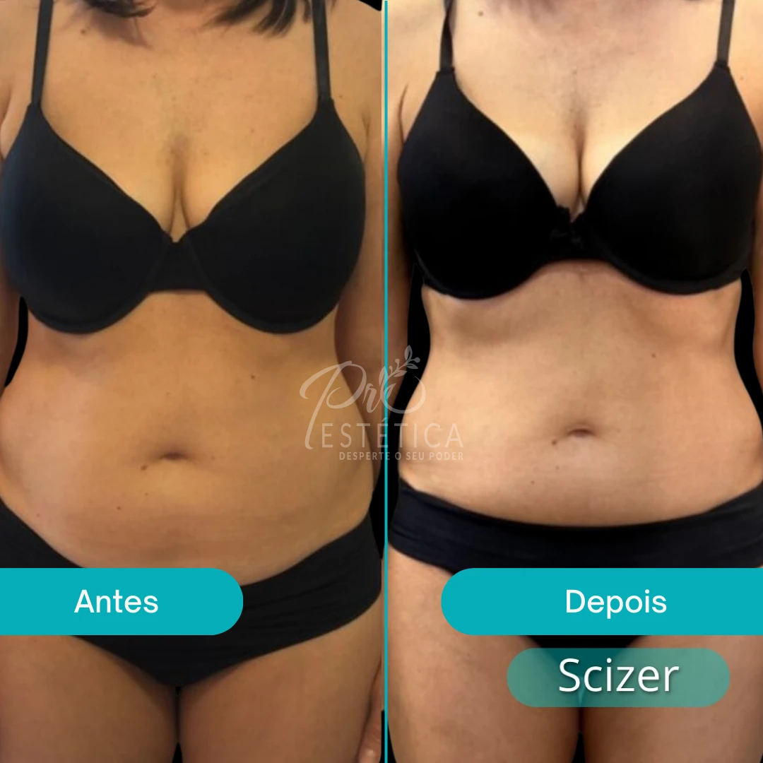 scizer (4) scizer (4)