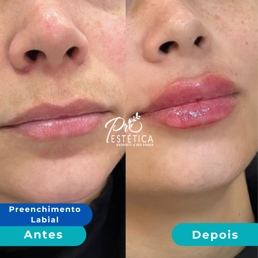 antes_e_depois_1__1x antes_e_depois_1__1x