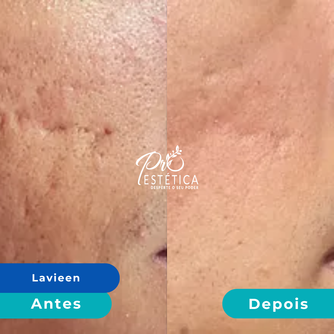 antes_e_depois_6__1x antes_e_depois_6__1x