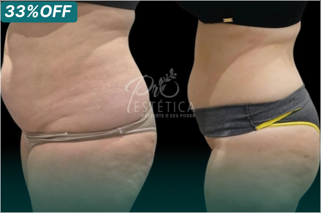 Página inicial 10 CM SLIM 1