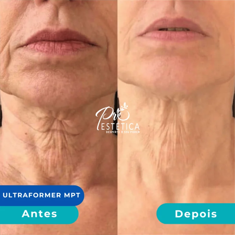 Página inicial 50 antes_e_depois_10__1x