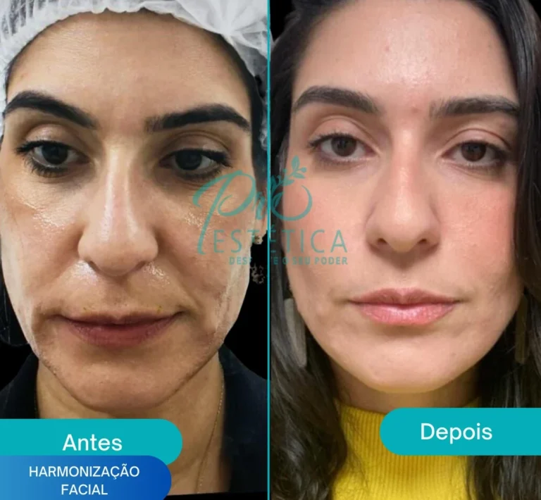 Página inicial 47 harmonizacao_facial_2_-e1727882427131